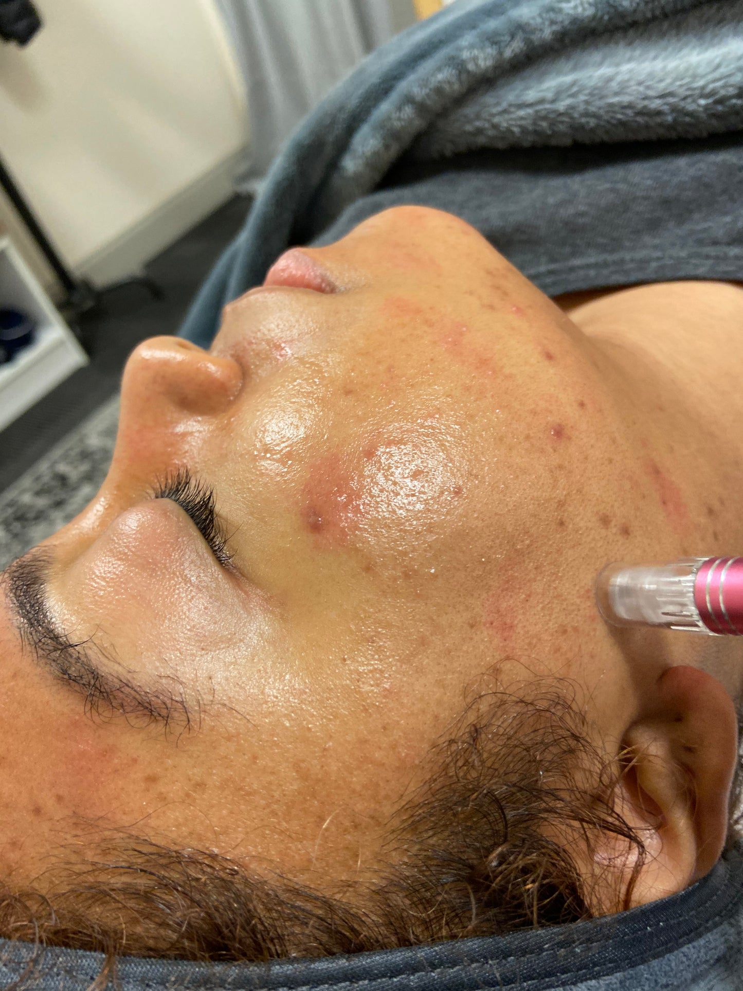 House call - Basic Facial