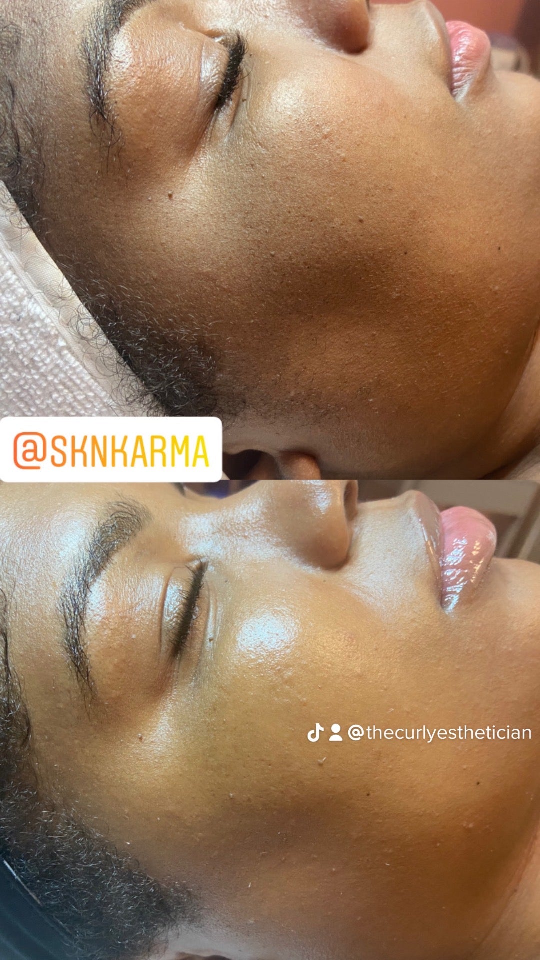 House call - Basic Facial
