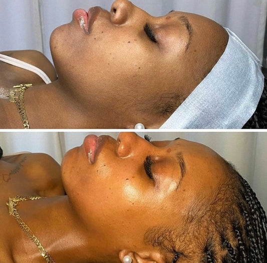 House call - Basic Facial